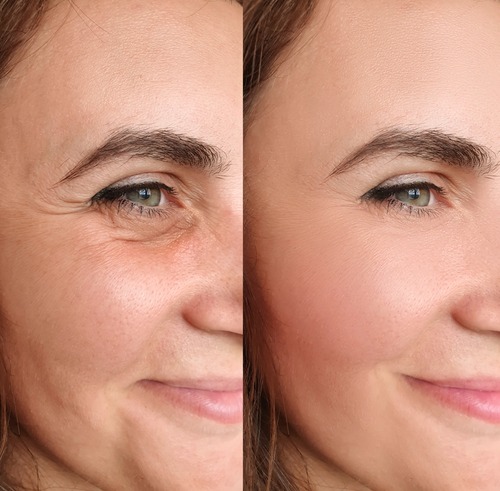 How to Tighten Sagging Skin on the Face